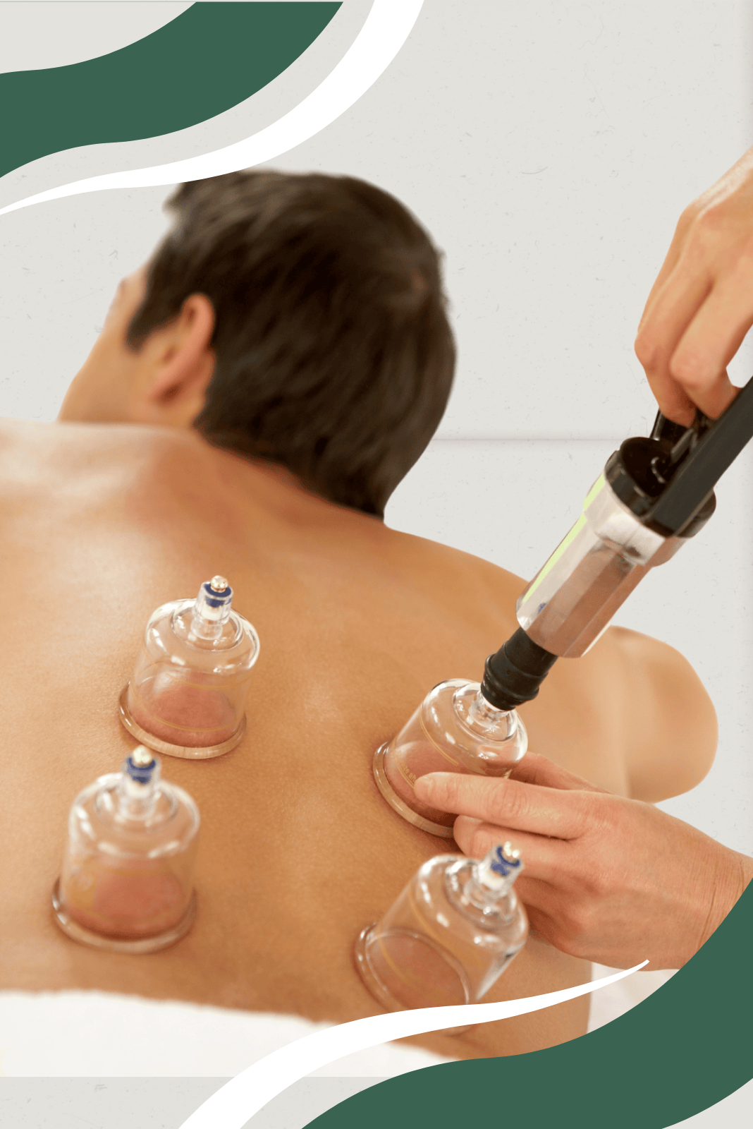 Cupping 1