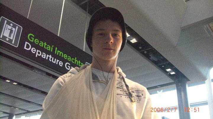 1st of many shoulder dislocations and surgeries